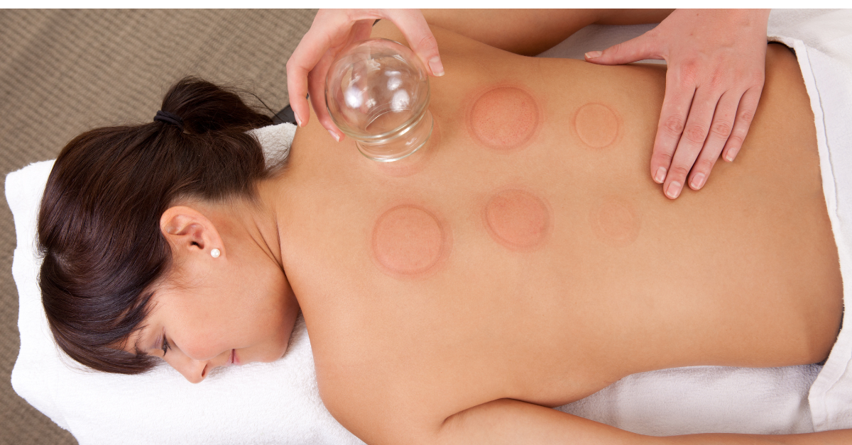 Professional cupping therapy procedure