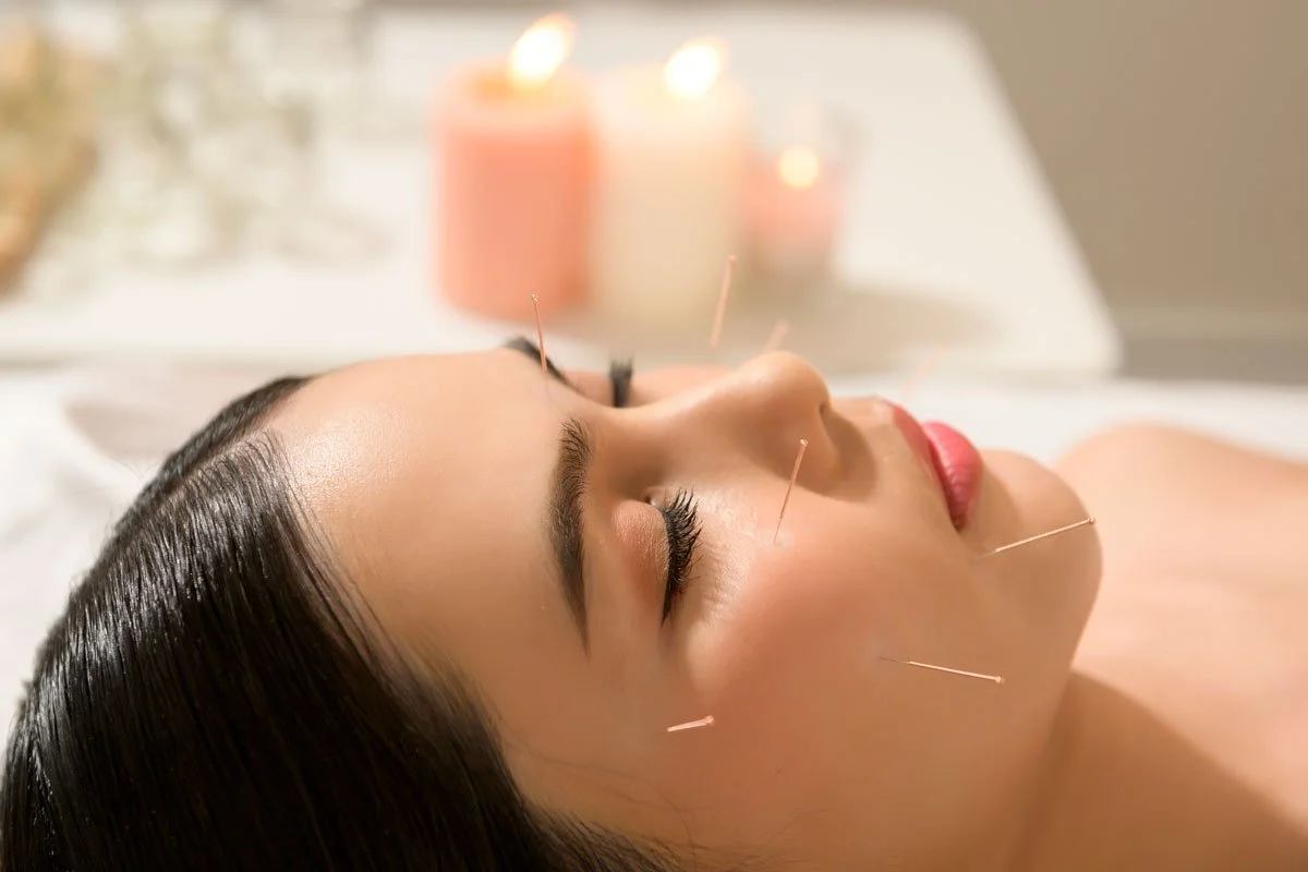 Cosmetic acupuncture